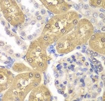 AKR1A1 Rabbit Polyclonal Antibody