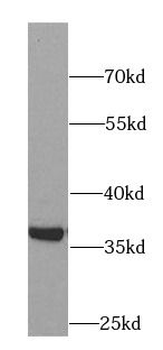 AKR1B1 Rabbit Polyclonal Antibody