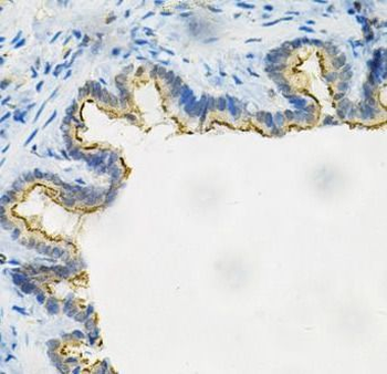 AKR1B1 Rabbit Polyclonal Antibody