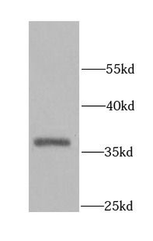 AKTIP Rabbit Polyclonal Antibody