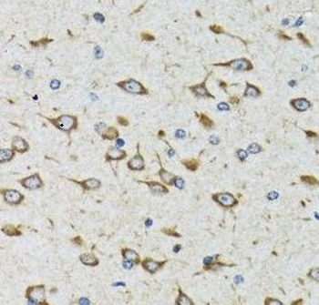 AKTIP Rabbit Polyclonal Antibody
