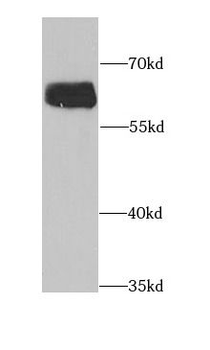 AAAS Rabbit Polyclonal Antibody