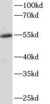 ALDH1A1 Mouse Monoclonal Antibody