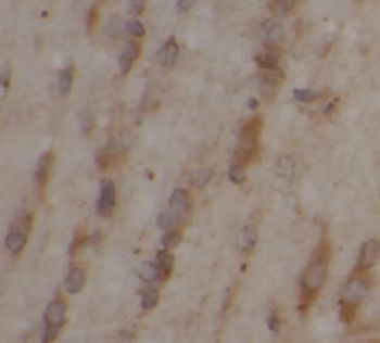 ALDH1A1 Mouse Monoclonal Antibody