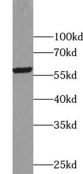 ALDH1A3 Rabbit Polyclonal Antibody