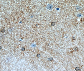 ALDH1L1 Antibody