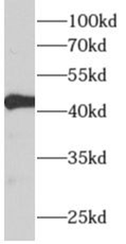 ALDH3B2 Rabbit Polyclonal Antibody