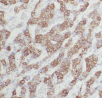 ALDH3B2 Rabbit Polyclonal Antibody