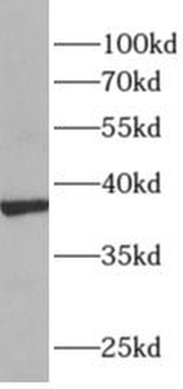 ALDOC Rabbit Polyclonal Antibody