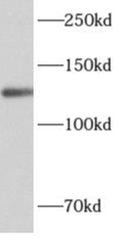 ALG13 Rabbit Polyclonal Antibody