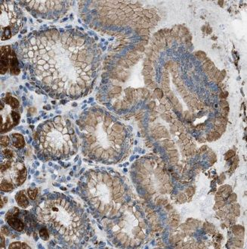 ALG13 Rabbit Polyclonal Antibody