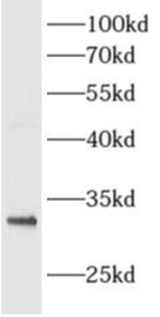 ALKBH3 Rabbit Polyclonal Antibody