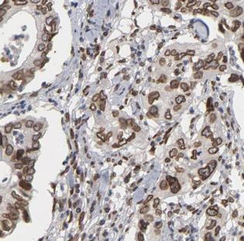 ALKBH3 Rabbit Polyclonal Antibody