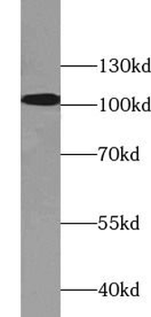 ACTN1 Antibody