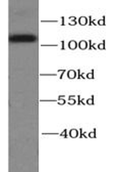 CTNNA1 Antibody