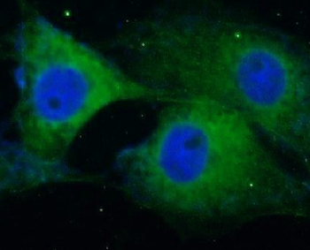 SNCA Rabbit Polyclonal Antibody
