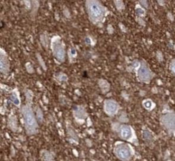 SNCA Rabbit Polyclonal Antibody