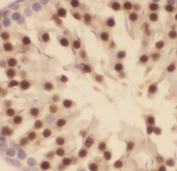 CARF Rabbit Polyclonal Antibody