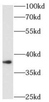 ALX1 Rabbit Polyclonal Antibody