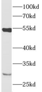 AMIGO3 Rabbit Polyclonal Antibody