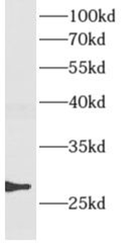 AMN1 Rabbit Polyclonal Antibody