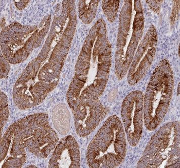 AMN1 Rabbit Polyclonal Antibody