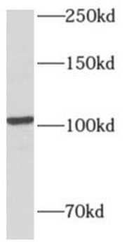 AMPD2 Rabbit Polyclonal Antibody