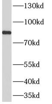 AMPD3 Rabbit Polyclonal Antibody