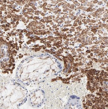 AMPD3 Rabbit Polyclonal Antibody