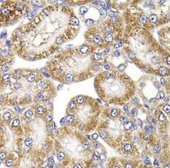 ANAPC5 Rabbit Polyclonal Antibody