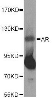 AR Rabbit Polyclonal Antibody
