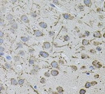 AR Rabbit Polyclonal Antibody