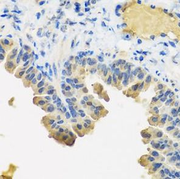 ANGPT1 Rabbit Polyclonal Antibody