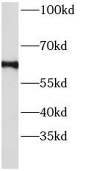 ANGPT2 Rabbit Polyclonal Antibody