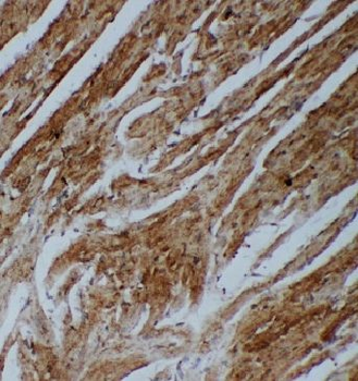 ANGPT2 Rabbit Polyclonal Antibody