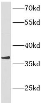 ANKRD1 Antibody