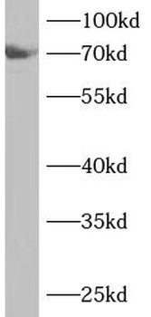 ANKS1B Antibody