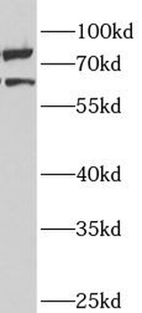 ANKS3 Rabbit Polyclonal Antibody