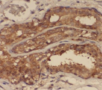 ANKS3 Rabbit Polyclonal Antibody