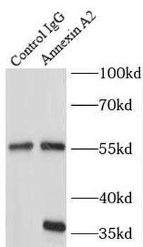 ANXA2 Mouse Monoclonal Antibody