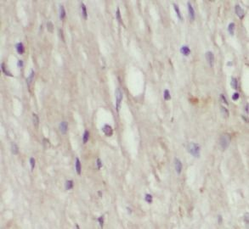 ANXA2 Mouse Monoclonal Antibody