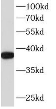 ANXA2 Mouse Monoclonal Antibody