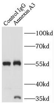 ANXA3 Antibody