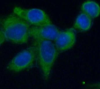 ANXA5 Mouse Monoclonal Antibody