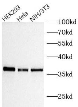 ANXA5 Mouse Monoclonal Antibody
