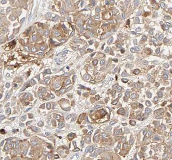 ANXA5 Mouse Monoclonal Antibody
