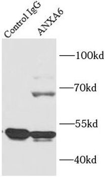 ANXA6 Antibody