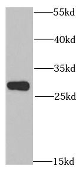 ANP32A Rabbit Polyclonal Antibody