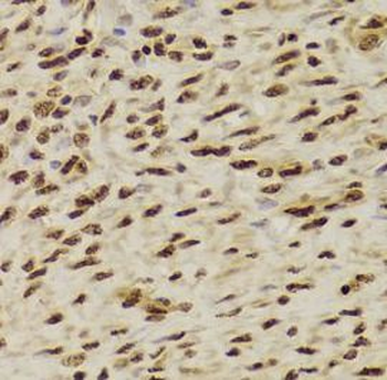 ANP32A Rabbit Polyclonal Antibody
