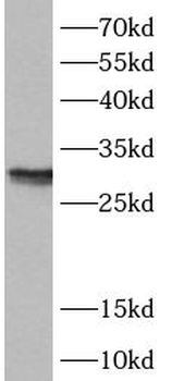 ANP32B Antibody